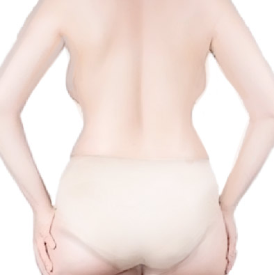 Гипертрофия жировых тканей спины и рук