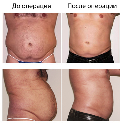 Результат операции