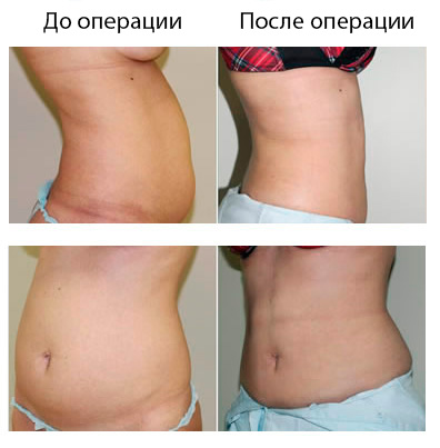 Результат операции