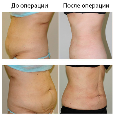 Результат операции