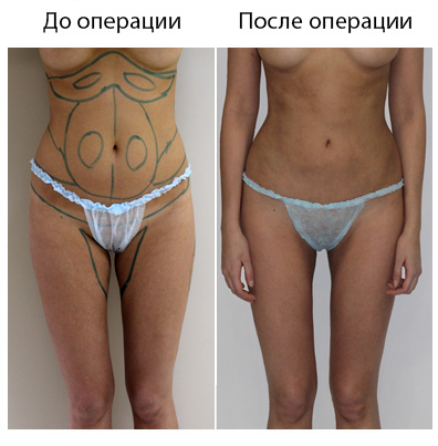 Результат операции